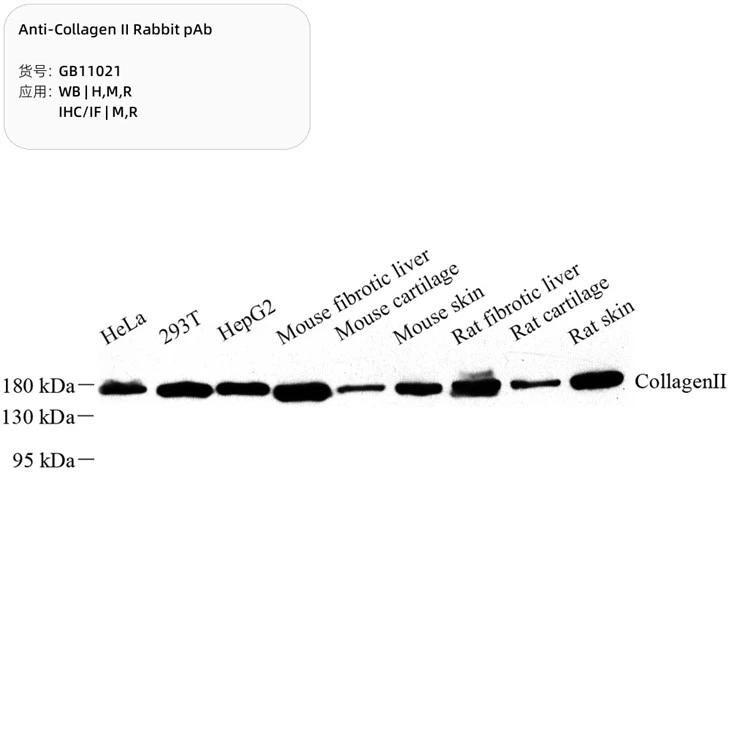 Anti-Collagen II Rabbit PAb