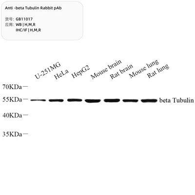 Pab cwningen twbulin gwrth-beta